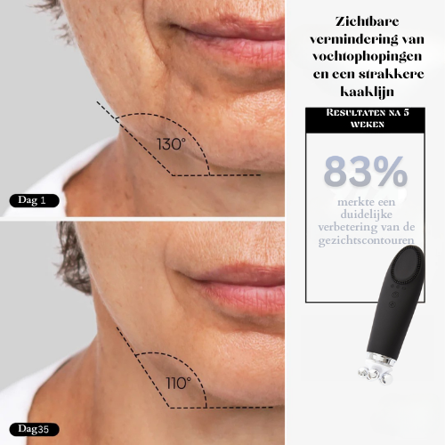 DERMASENSE™ – Herstel je huid van binnenuit
